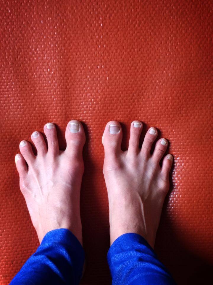 Healthy Feet February 7th 2015